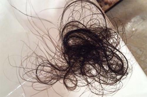 ������ͷ����Ƥ��������ҽ���������Ԥ���ѷ�