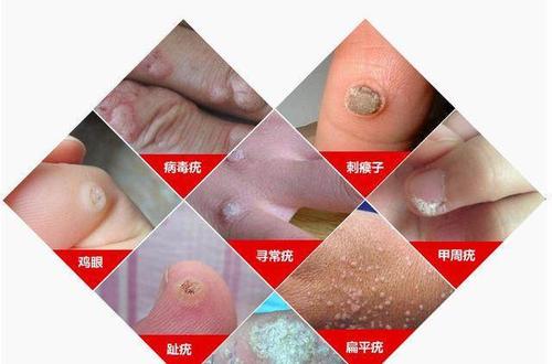 �ഫȾ��̨��Ƥ���ƽ�����ĳ������ͼ�ע������