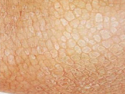 ���۲�֢״ͼ