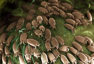 皮肤出现这三种情况小心是螨虫超标