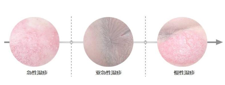 ���ݿ�ʪ���Ƥ����ҽԺ�ļ��շ�ƽ��