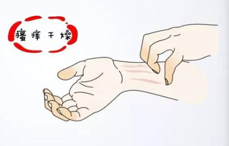 皮肤瘙痒什么原因?福州皮肤科医院:小心五种原因