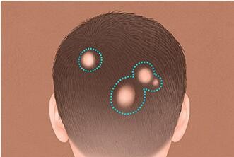 ����Ƥ���ƣ������ͺ��ԭ����ʲô����ô����