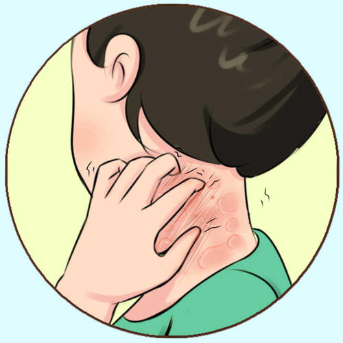 ����ʪ����ô�죿����Ƥ����ҽԺ���������